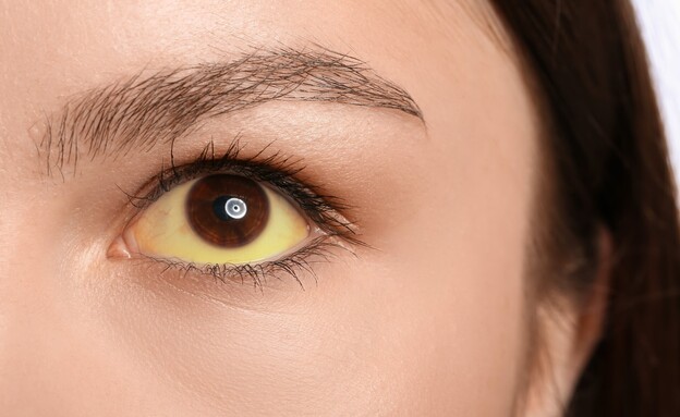 עין צהובה (צילום: shutterstock)
