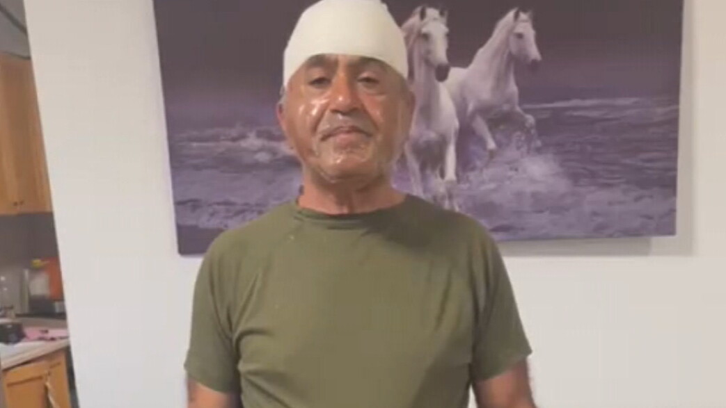 "המדביר המזמר" שהותקף באלימות בשטחים