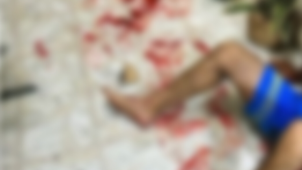 דקר בגלל כלב נובח דקר בגלל כלב נובח