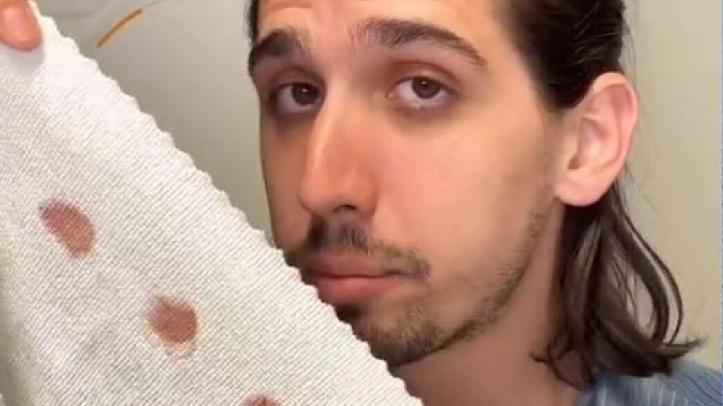 מסיר כתמים מסיר כתמים