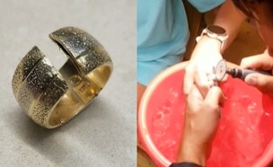 הטבעת נתקעה על האצבע (צילום: מתוך "חדשות הבוקר" , קשת 12)