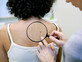סרטן העור (צילום: Image Point Fr, Shutterstock)