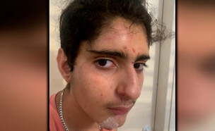 נער עם מוגבלות הוכה ללא סיבה בגן ציבורי (צילום: מתוך "חדשות הבוקר" , קשת12)