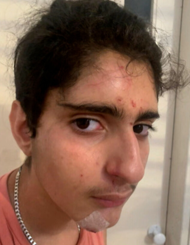 נער עם מוגבלות הוכה ללא סיבה בגן ציבורי (צילום: מתוך "חדשות הבוקר" , קשת12)