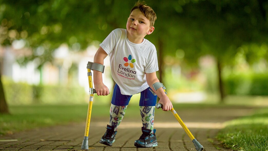 טוני הודגל, רגליו נקטעו לאחר התעללות הוריו