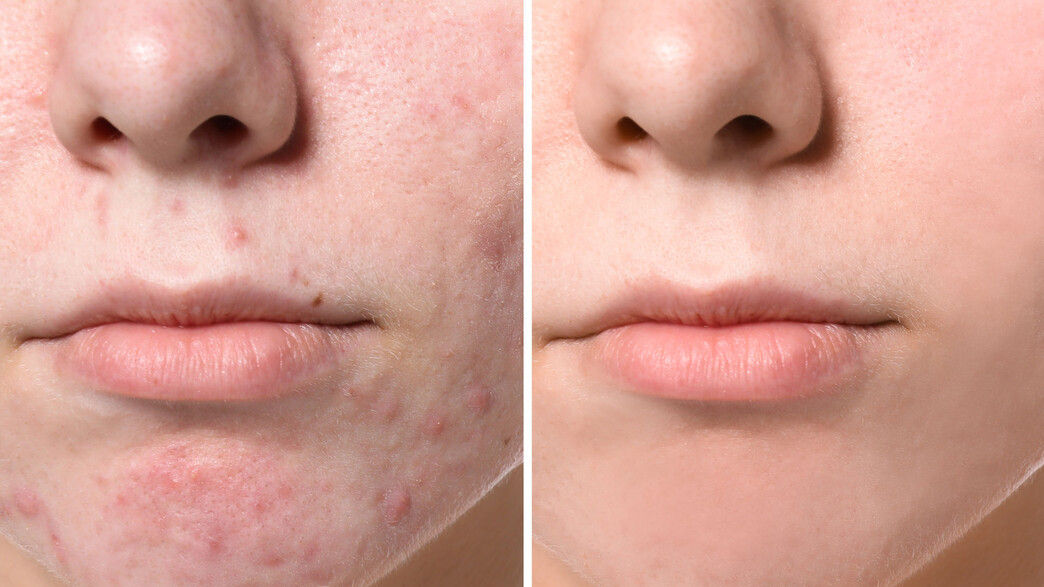 פנים, לפני ואחרי פנים, לפני ואחרי