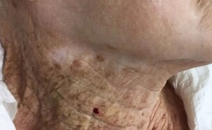 עור בת 92 (צילום: טוויטר)