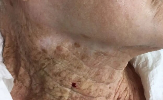 עור בת 92 (צילום: טוויטר)