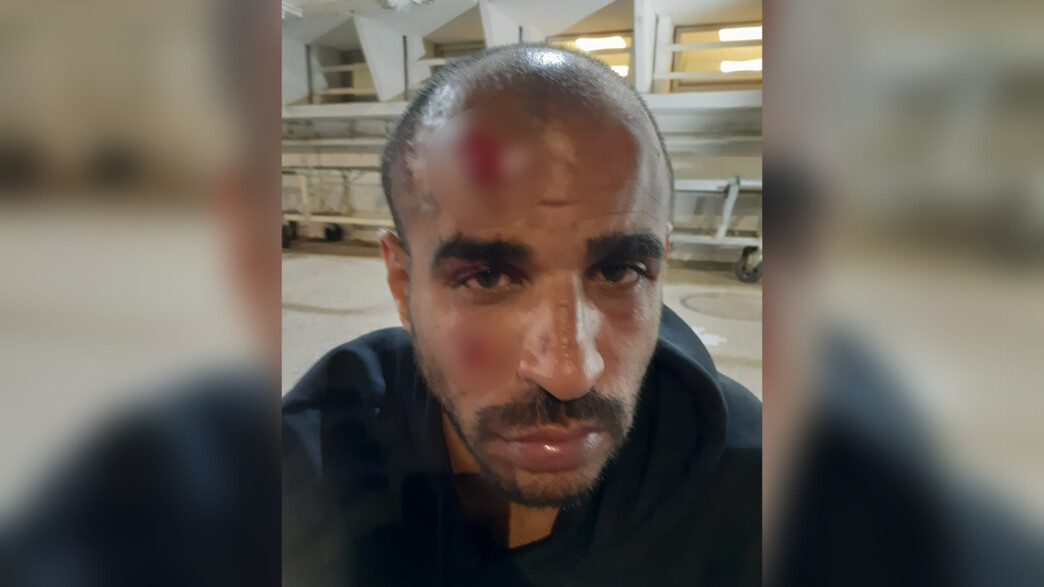 נפצע בניסיון לינץ' בבת ים