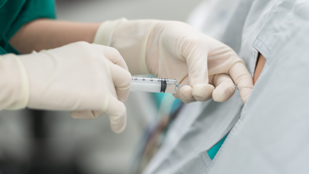 זריקת אפידורל, אילוסטרציה