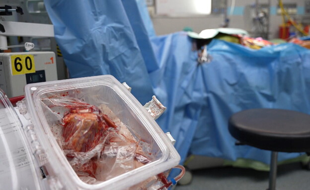 המכשיר שמכפיל את הזמן שבו הלב נמצא מחוץ לגוף (צילום: רועי קסטרו, בית החולים בלינסון)
