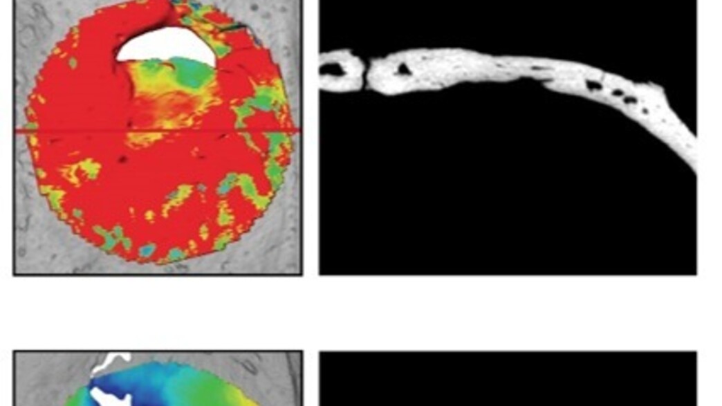 מחקר פורץ דרך לשחזור עצמות מחקר פורץ דרך לשחזור עצמות