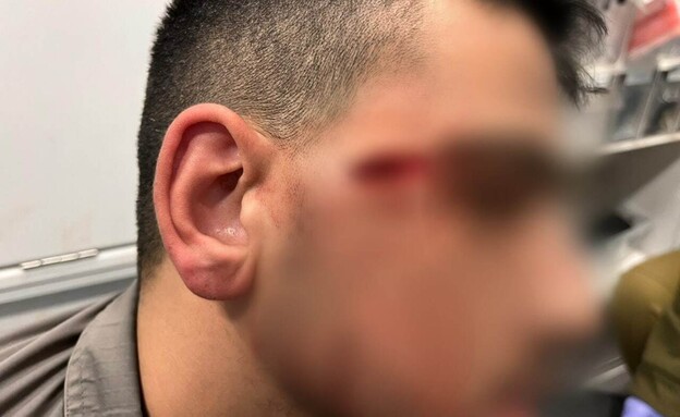 הפיגוע בחווארה: חייל מג"ב נפצע קל (צילום: מג"ב)