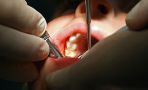 נכלל בביטוח: טיפולי שיניים לילדים (צילום: rf123.com, Claudia Otte)