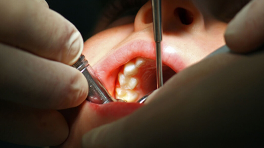 נכלל בביטוח: טיפולי שיניים לילדים (צילום: rf123.com, Claudia Otte)