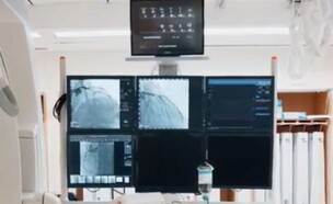 מכשיר הרנטגן בבי"ח בילינסון (צילום: מתוך הסרטון של ביה״ח בילינסון)