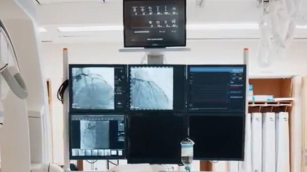 מכשיר הרנטגן בבי"ח בילינסון