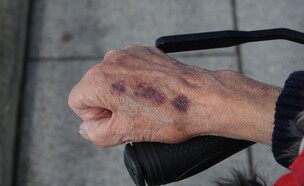 אלימות בזקנה (צילום: shutterstock | RogerMechan)