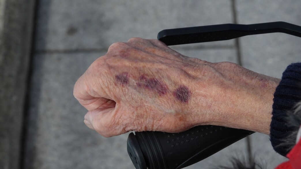 אלימות בזקנה (צילום: shutterstock | RogerMechan)
