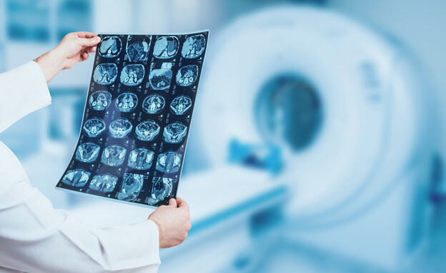 רופא בוחן בדיקת MRI (צילום: 123RF‏)