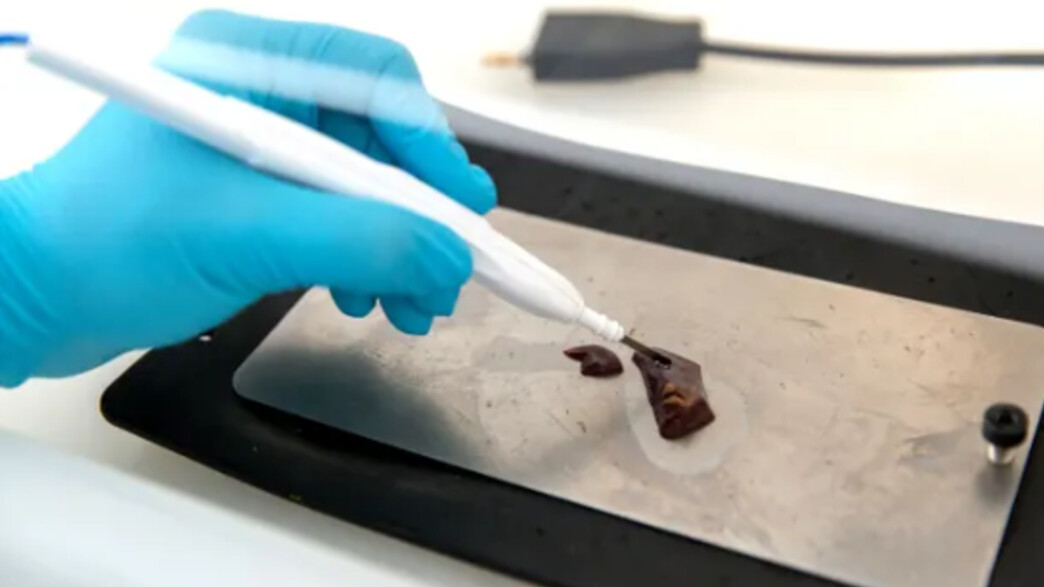 סכין מנתחים דיגיטלית