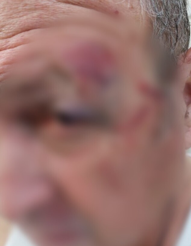 בן ה-72 שהותקף על ידי נהג בקניון ברחובות (צילום: רחובות ניוז)
