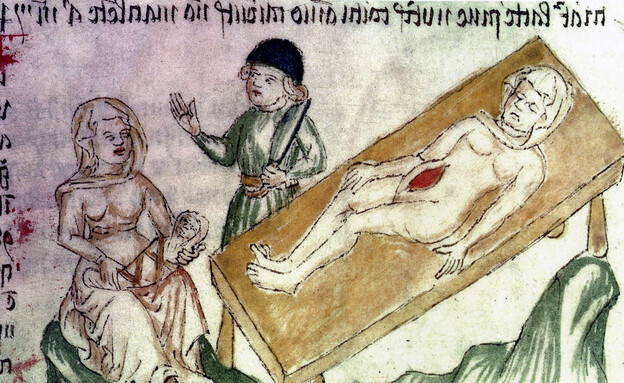 ניתוח קיסרי בימי הביניים (צילום: Apocalypse/Buyenlarge, Getty Images)
