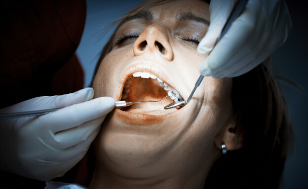 טיפול שיניים (צילום: Shutterstock)