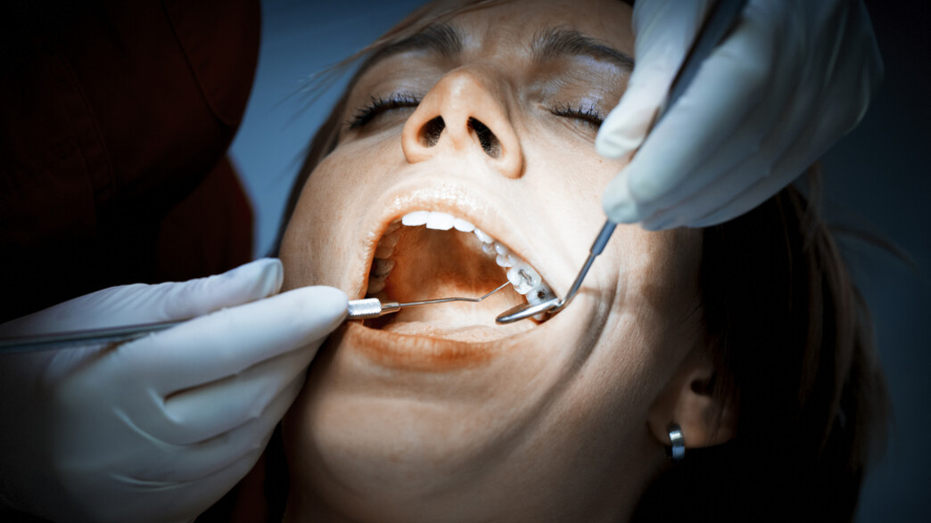 טיפול שיניים