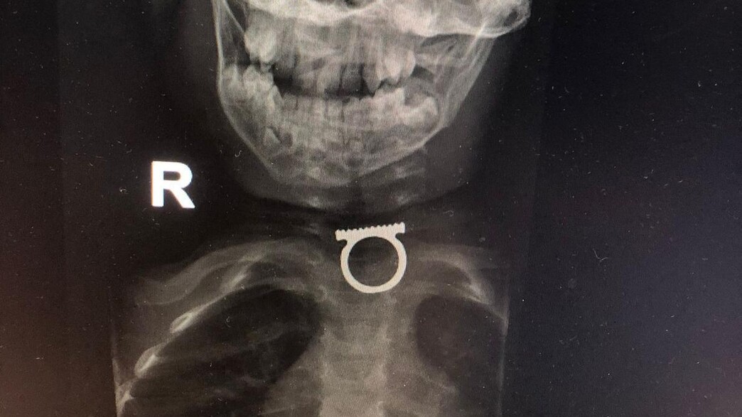 צילום רנטגן של אדם צילום רנטגן של אדם