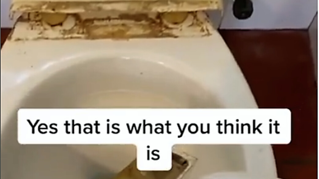 הצטברות שתן באסלה