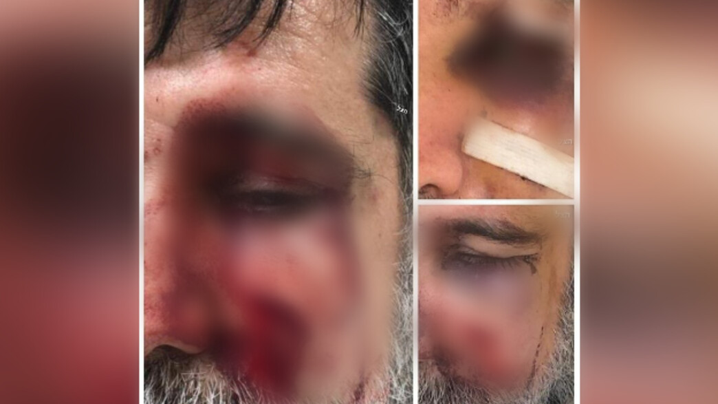 חרדי שלטענתו הותקף בהפגנת שמאל