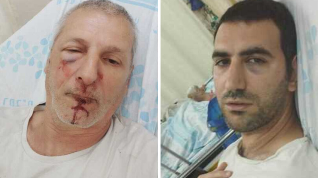 הפצועים מהתקיפה בצפון הפצועים מהתקיפה בצפון