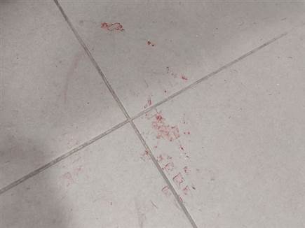 כתמי הדם בחדר השירותים בטרנר (צילום: ספורט 5)