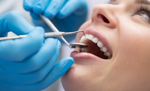 רופא שיניים, טיפול שיניים (צילום: bezikus, shutterstock)