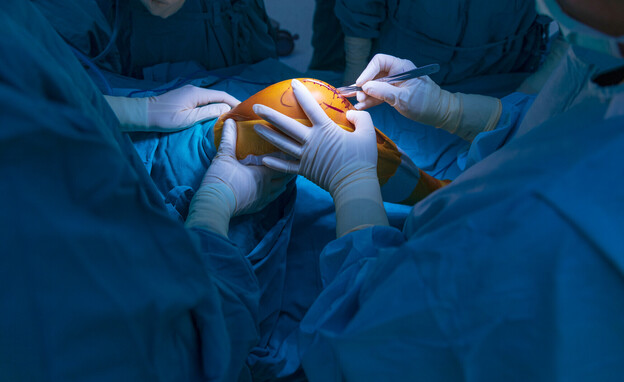 ניתוח ברך אינפומד (צילום: Peter Porrini)