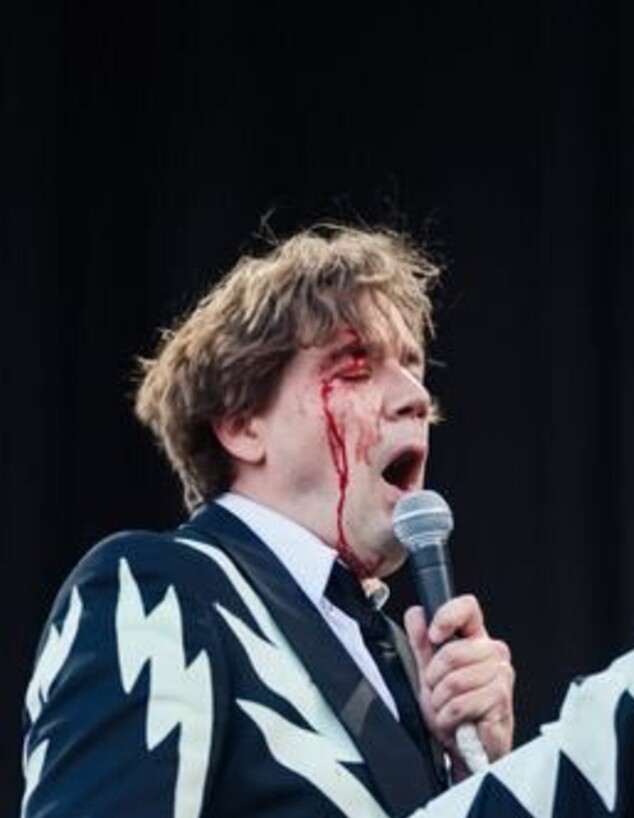 סולן להקת The Hives מדמם מהראש