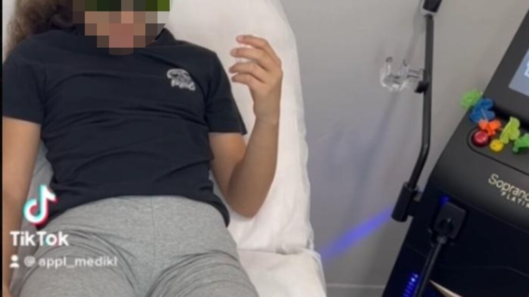 ילדה מסירה שיער בלייזר