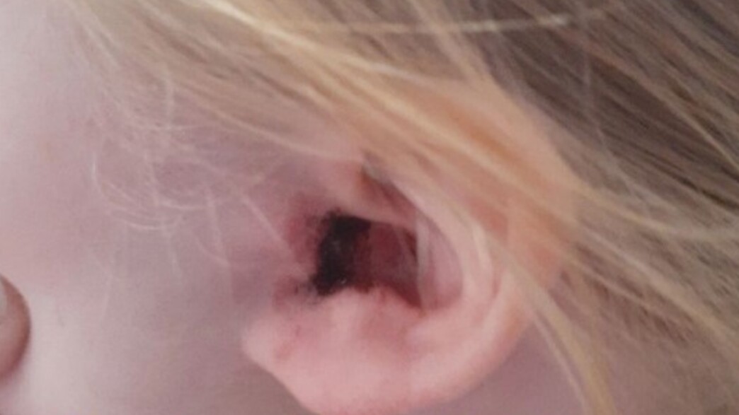 הגירוי באוזן של הילדה מהטיקטוק הגירוי באוזן של הילדה מהטיקטוק