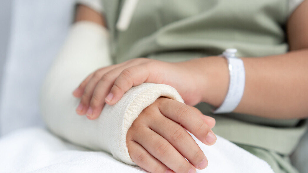 שבר, גבס, יד שבורה שבר, גבס, יד שבורה