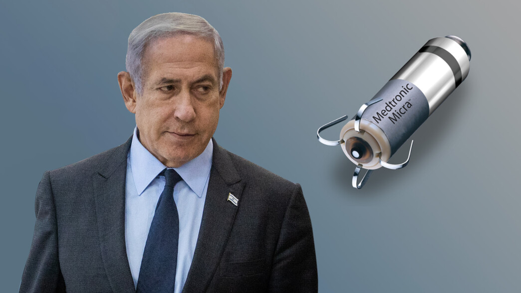קוצב הלב שהושתל בראש הממשלה נתניהו קוצב הלב שהושתל בראש הממשלה נתניהו