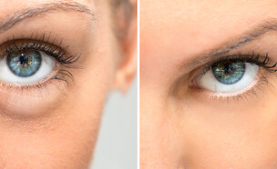 עיניים (צילום: Shutterstock)