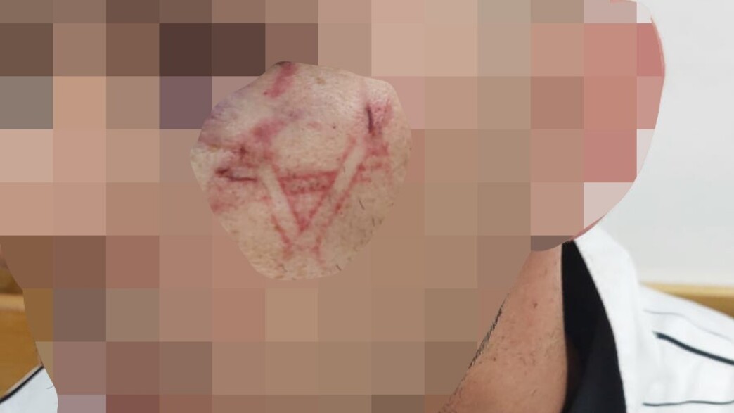 החשוד בהחזקת סמים שנעצר