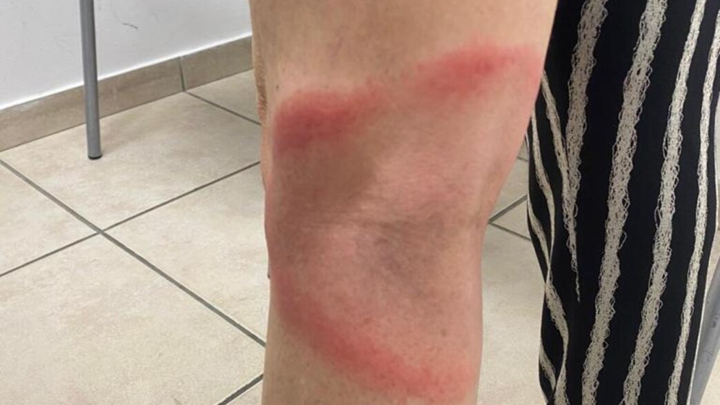 ישראלית, טיילה, יערות, צ'כיה, קרצייה ישראלית, טיילה, יערות, צ'כיה, קרצייה