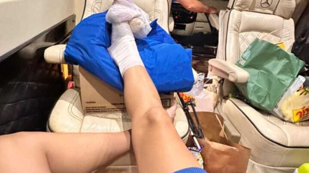 נגה ארז שברה כף רגל נגה ארז שברה כף רגל