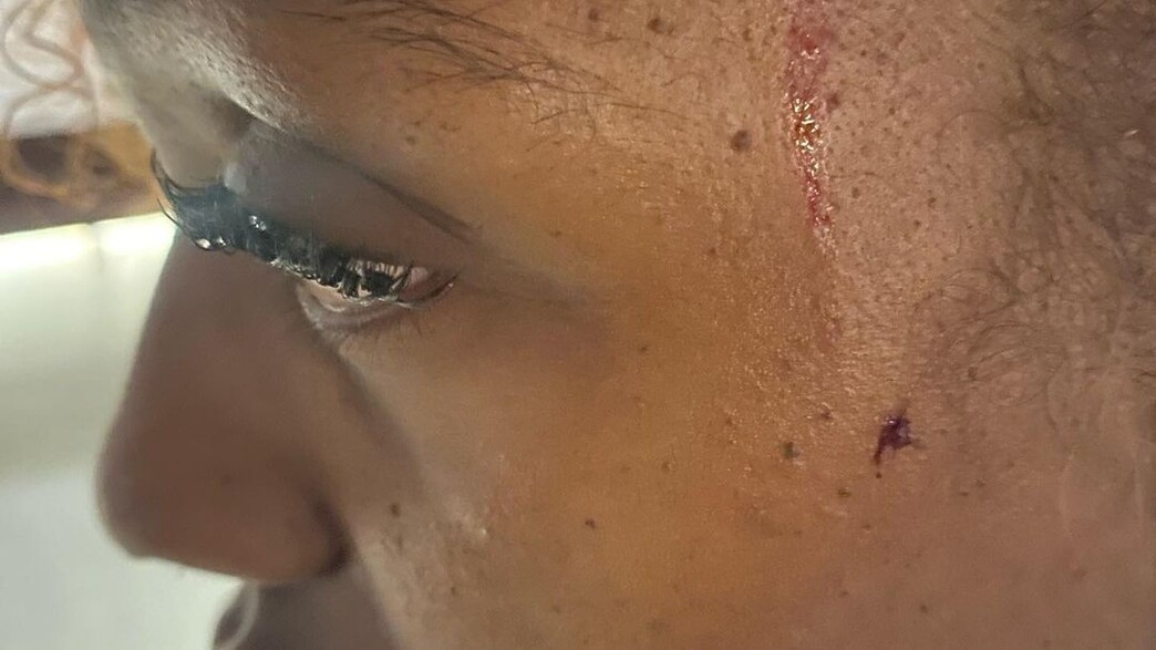 צעירה שהותקפה על ידי דיג'יי (צילום: אינסטגרם)