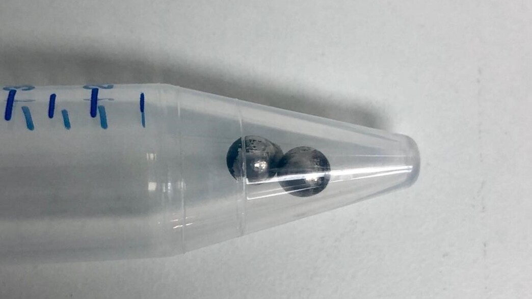 כדוריות מגנט שהוצאו מבטנה של ירדן כהן (צילום: באדיבות המרכז הרפואי מאיר)