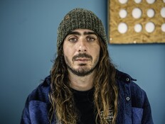 "אחד לטריליון": התסמונת הנדירה של סולן "הפיל הכחול"