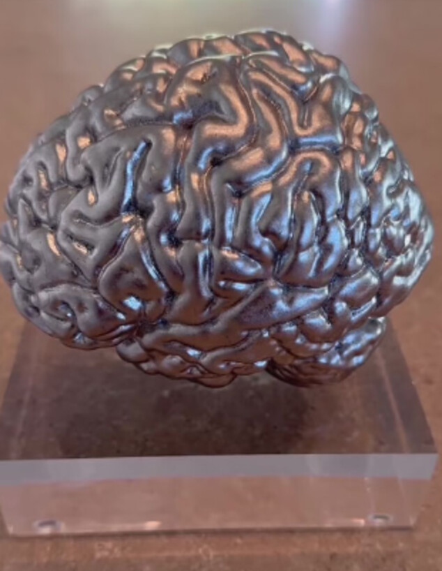 המוח של קים קרדשיאן (צילום: מתוך האינסטגרם של קים קרדשיאן)