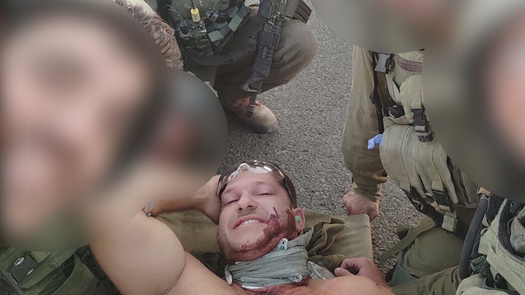 איתי שגיא לאחר הפציעה איתי שגיא לאחר הפציעה